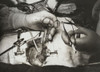 Close-up of surgeon's hands performing open-heart surgery Poster Print - Item # VARSAL990118165