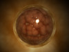 Microscopic view of a blastula during pregnancy Poster Print - Item # VARPSTSTK700307H