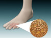 Anatomy of foot fungus with microscopic close-up Poster Print - Item # VARPSTSTK700573H