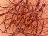 Microscopic view of Anthrax. Anthrax is an acute disease caused by the bacterium Bacillus anthracis. Most forms of the disease are lethal, and it affects both humans and animals Poster Print - Item # VARPSTSTK700105H