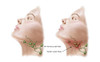 Anatomy of swollen lymph nodes Poster Print - Item # VARPSTSTK700231H