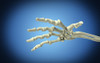 Conceptual image of bones in human hand Poster Print - Item # VARPSTSTK700069H