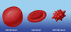 Osmotic Pressure on Blood Cells Poster Print by Monica Schroeder/Science Source - Item # VARSCIBS1967