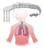Air Pollution and Lungs Poster Print by Spencer Sutton/Science Source - Item # VARSCIBZ4291