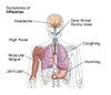 Symptoms of Influenza Poster Print by Spencer Sutton/Science Source - Item # VARSCIJB9153