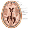 Transverse Section of the Brain Poster Print by Evan Oto/Science Source - Item # VARSCIBV8976