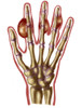 Hand with gout Poster Print by Spencer Sutton/Science Source - Item # VARSCIBU0961