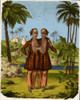 Chang and Eng, Siamese Twins Poster Print by Science Source - Item # VARSCIJC9506