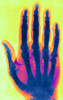 Early X-ray Poster Print by Science Source