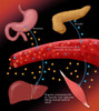 Type II Diabetes Poster Print by Monica Schroeder/Science Source - Item # VARSCIBY4052