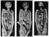 Processes of Mummification Poster Print by Science Source - Item # VARSCIJB3423