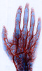 X-ray of Blood Vessels Poster Print by Science Source - Item # VARSCIBS4854