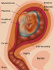 Fetus Illustration Poster Print by Gwen Shockey/Science Source