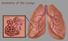 Lungs and Alveoli Poster Print by Gwen Shockey/Science Source - Item # VARSCIBZ3612