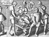 Trepanning Being Performed, 1594 Poster Print by Science Source - Item # VARSCIJA0945