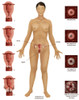 Cervical Cancer Poster Print by Gwen Shockey/Science Source - Item # VARSCIBW1345