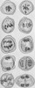 Cell division Poster Print by Science Source - Item # VARSCIBD9298