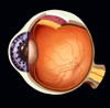 Eye Poster Print by Spencer Sutton/Science Source - Item # VARSCIBW0798