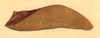 Fatty Liver, Pathology, Illustration, 1852 Poster Print by Science Source
