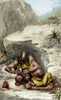 Prehistoric Surgical Operation, Cautery Poster Print by Science Source