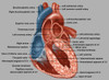 Heart Anatomy Poster Print by Gwen Shockey/Science Source - Item # VARSCIBZ1716