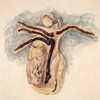 Thrombosis, Pulmonary Artery, Illustration, 1893 Poster Print by Science Source - Item # VARSCIJA1810