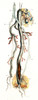 Amputated Nerve and Artery, Illustration Poster Print by Science Source - Item # VARSCIJB6891