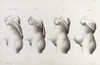 Pregnancy, Trimesters, Illustration, 1822 Poster Print by Science Source - Item # VARSCIJA1793