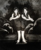 Daisy and Violet Hilton, Conjoined Twins, 1927 Poster Print by Science Source - Item # VARSCIJB2945