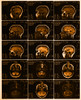 MRI of Normal Brain Poster Print by Science Source - Item # VARSCIBU9042