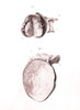 Ovarian Disease, Illustration, 1802 Poster Print by Science Source - Item # VARSCIJA1832