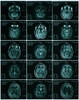 MRI of Normal Brain Poster Print by Science Source - Item # VARSCIBT9001