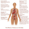 Effects of Tobacco Use Poster Print by Gwen Shockey/Science Source - Item # VARSCIBX8295