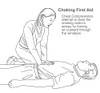 Choking First Aid Poster Print by Gwen Shockey/Science Source - Item # VARSCIBY1933