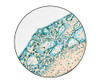 Congestion in Lungs, 1918 Influenza Poster Print by Science Source - Item # VARSCIJC0500