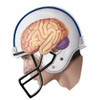 Concussion Poster Print by Spencer Sutton/Science Source - Item # VARSCIBV1163