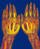 X-Ray of Two Normal Hands, 1896 Poster Print by Science Source