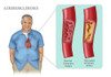 Man with Heart Disease, Illustration Poster Print by Monica Schroeder/Science Source - Item # VARSCIJB7847