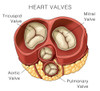 Heart Valves, Illustration Poster Print by Monica Schroeder/Science Source - Item # VARSCIJB5253