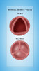 Normal Aortic Valve Poster Print by Monica Schroeder/Science Source - Item # VARSCIBY4108