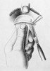 Surgery to Correct Lazy Upper Eyelid, c, 1830 Poster Print by Science Source