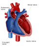 Heart Valves Poster Print by Monica Schroeder/Science Source - Item # VARSCIBY4104