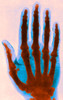 Early X-ray Poster Print by Science Source