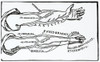 Arteries Poster Print by Science Source - Item # VARSCI9N0098