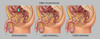 Types of Incontinence in Male Anatomy Poster Print by Gwen Shockey/Science Source - Item # VARSCIJB6977