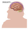 Alzheimer's, Illustration Poster Print by Gwen Shockey/Science Source - Item # VARSCIJC6240