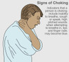 Signs of Choking Poster Print by Gwen Shockey/Science Source - Item # VARSCIBY1949