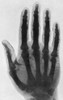 Early X-ray Poster Print by Science Source - Item # VARSCIBS4858