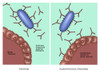 Normal Immune System & Autoimmune Disease Poster Print by Gwen Shockey/Science Source - Item # VARSCIJC1034