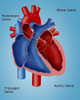 Heart Valves Poster Print by Monica Schroeder/Science Source - Item # VARSCIBY4103